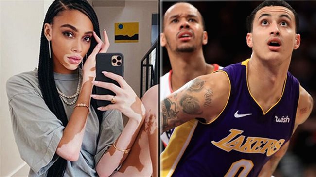 Winnie Harlow y Kuzma