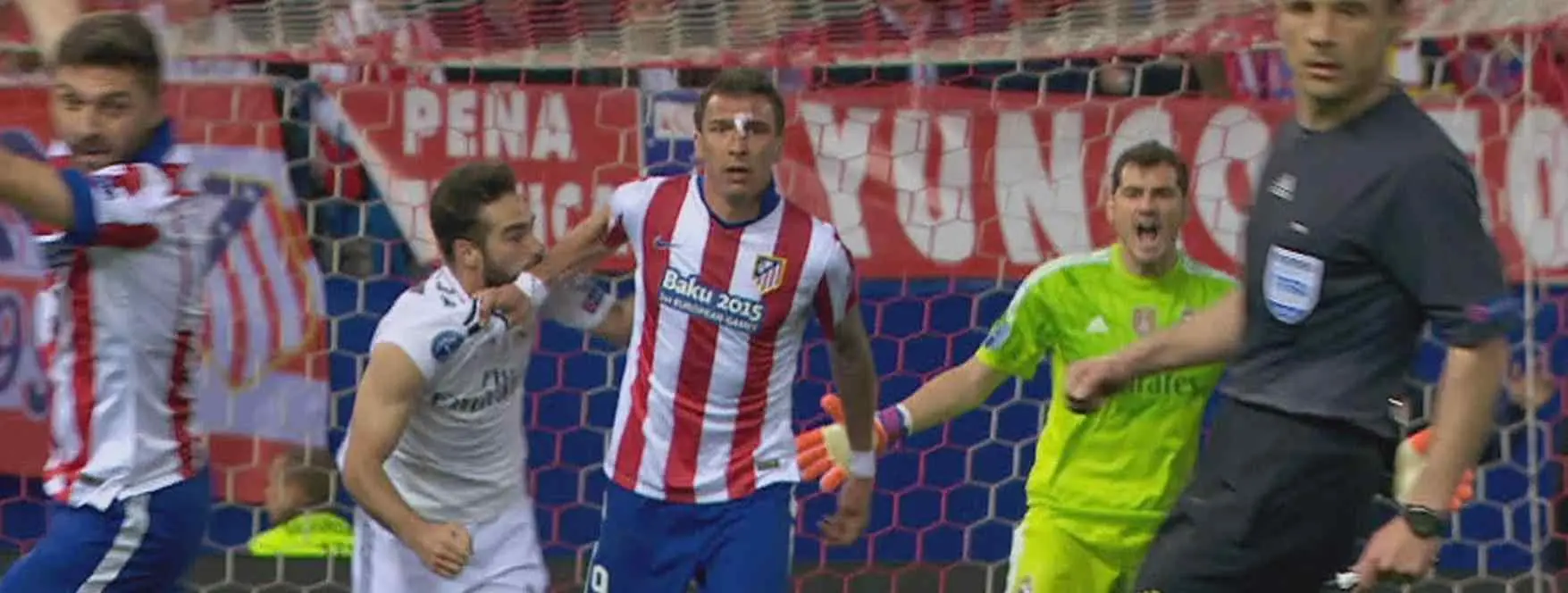 Así quedó el brazo de Mandzukic: ¿Tendrá algo que ver Carvajal?